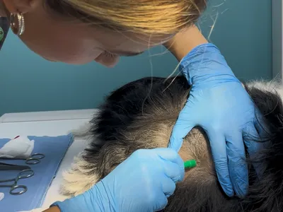 Biopsija kože pod anestezijom