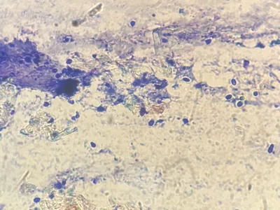 Citološka analiza u laboratoriji